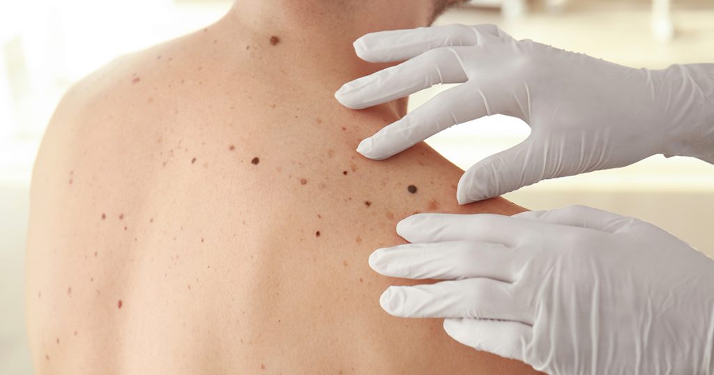 Dermatologia e chirurgia dermatologica a Roma